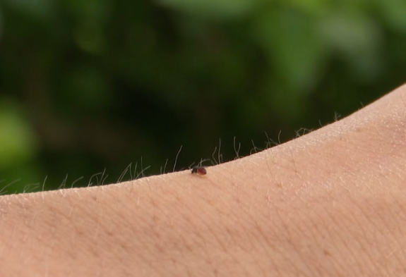 警惕有人被咬后进急诊这种小虫公园常见