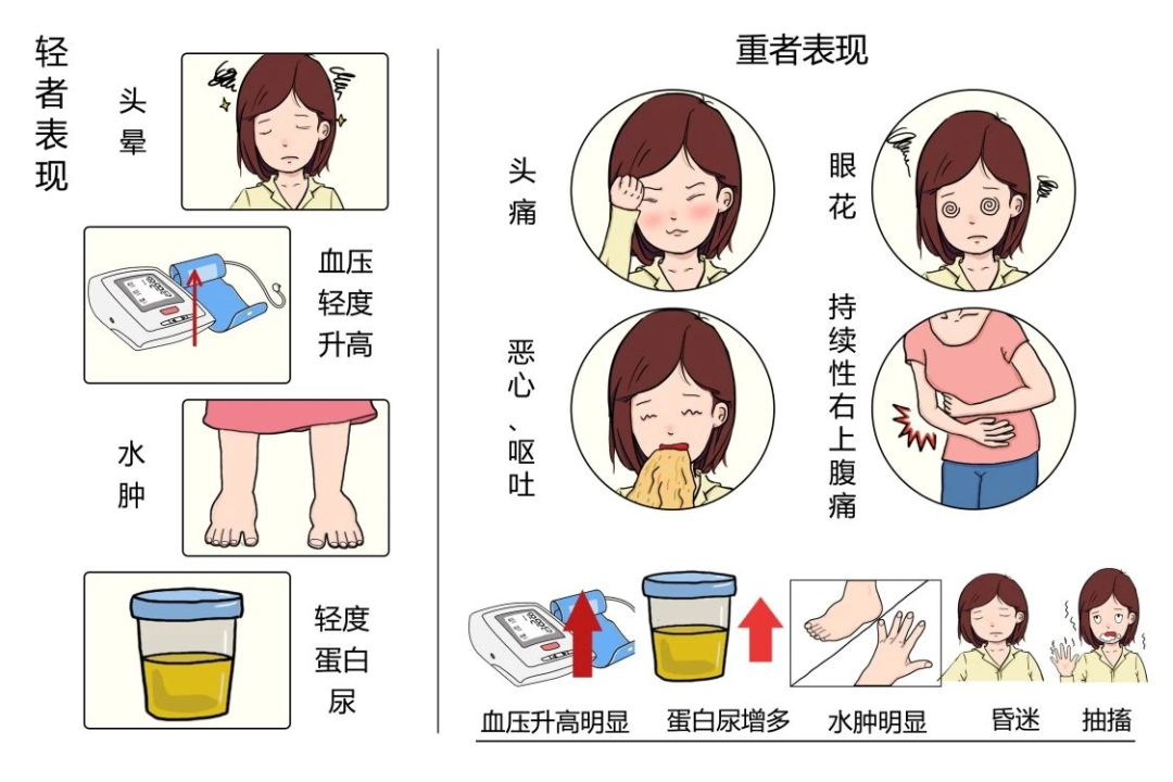 怎样预防妊娠期高血压疾病这5个秘诀要提前明白