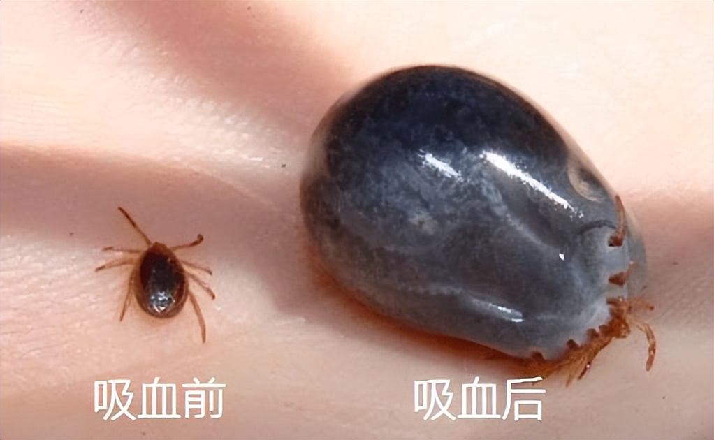 蜱虫的危害需重新审视河南有三人因蜱虫病逝却从未被蜱虫咬过