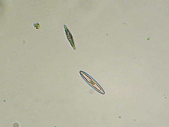 舟形藻(硅藻门)飞燕角甲藻(甲藻门)席藻(蓝藻门)新月藻(绿藻门)单角