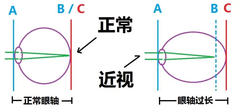 做完近视手术也不能放纵！这一类人尤其要注意休闲区蓝鸢梦想 - Www.slyday.coM