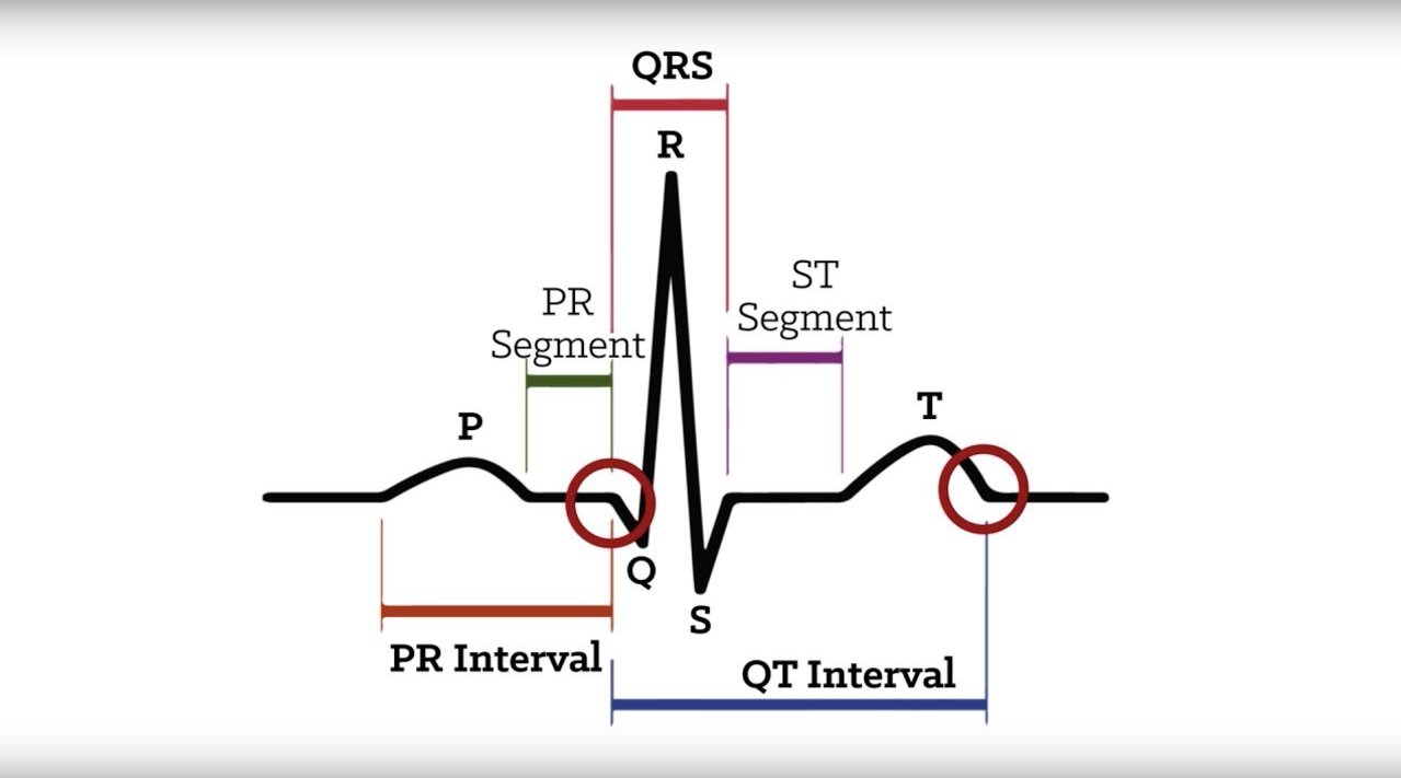 qrs电轴 新浪（移动端）