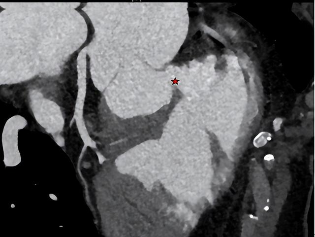 罕见！29岁小伙同时有4种心脏畸形！一次手术全部修复休闲区蓝鸢梦想 - Www.slyday.coM