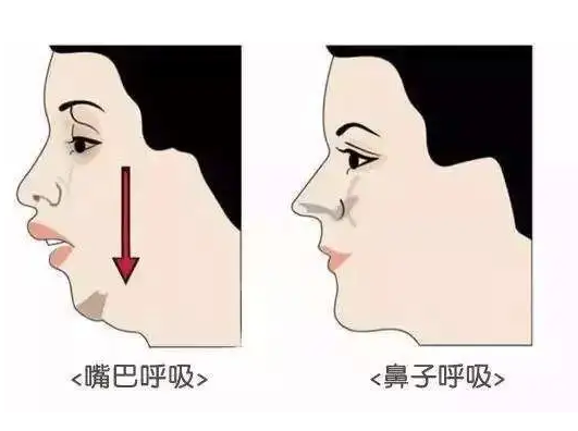 龅牙,鼻子扁平等问题,最终影响宝宝的颜值.