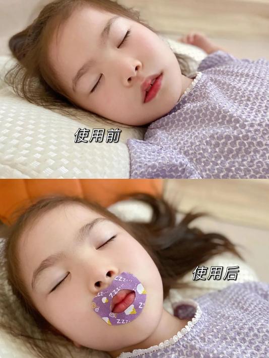 宝宝睡觉用嘴呼吸该如何纠正呢?|宝宝|上牙弓|龅牙_新浪新闻