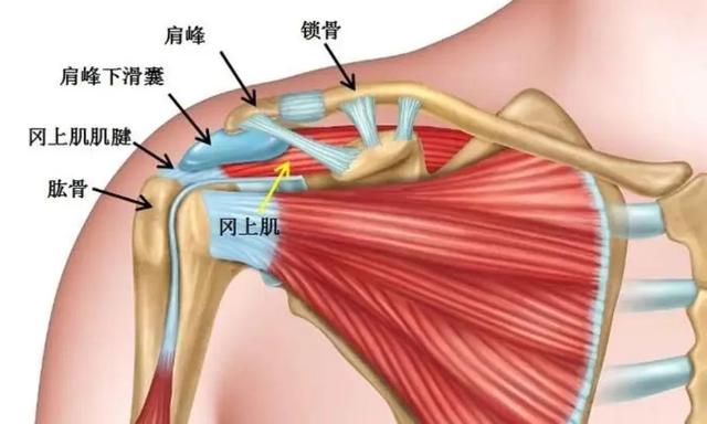 其中,肩峰下滑囊炎,肱二头肌长头键鞘炎,冈上肌腱鞘炎等,多由长期慢性