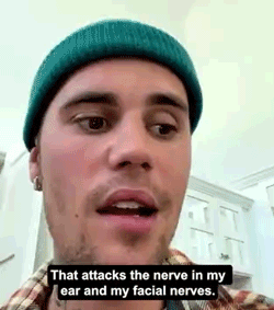 28岁贾斯汀·比伯自爆面瘫,右侧脸无法动,爱妻不久前患脑血栓休闲区蓝鸢梦想 - Www.slyday.coM 28岁贾斯汀·比伯自爆面瘫,右侧脸无法动,爱妻不久前患脑血栓休闲区蓝鸢梦想 - Www.slyday.coM