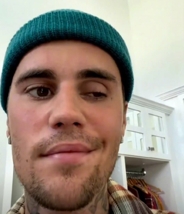 小天王比伯得怪病右脸面瘫？晒自拍不能眨眼不能笑，或损失上亿休闲区蓝鸢梦想 - Www.slyday.coM