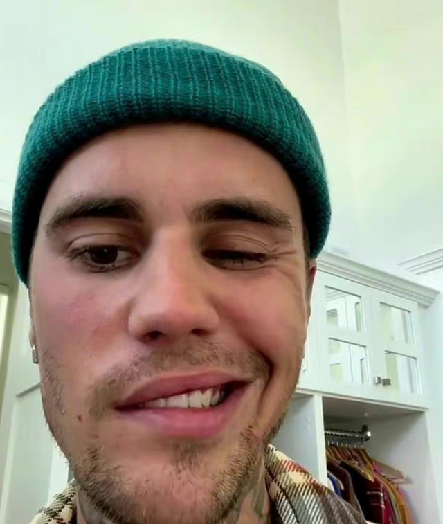 小天王比伯得怪病右脸面瘫？晒自拍不能眨眼不能笑，或损失上亿休闲区蓝鸢梦想 - Www.slyday.coM