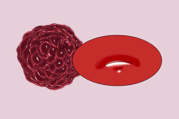 肿瘤专家患癌后，是如何面对化疗的？有3类患者，化疗弊大于利休闲区蓝鸢梦想 - Www.slyday.coM