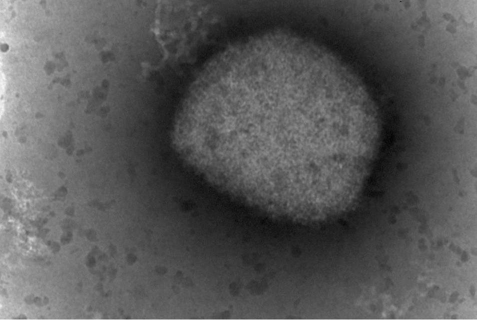 美国疾控中心官员反驳猴痘可以通过空气传播的说法休闲区蓝鸢梦想 - Www.slyday.coM