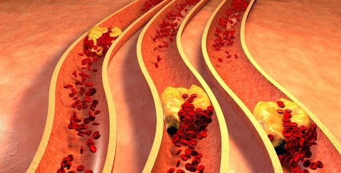 医生:3个症状一出现,说明你的血脂太高了!别再当做没看见休闲区蓝鸢梦想 - Www.slyday.coM 医生:3个症状一出现,说明你的血脂太高了!别再当做没看见休闲区蓝鸢梦想 - Www.slyday.coM