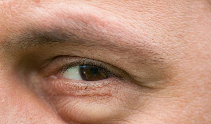 医生:3个症状一出现,说明你的血脂太高了!别再当做没看见休闲区蓝鸢梦想 - Www.slyday.coM 医生:3个症状一出现,说明你的血脂太高了!别再当做没看见休闲区蓝鸢梦想 - Www.slyday.coM