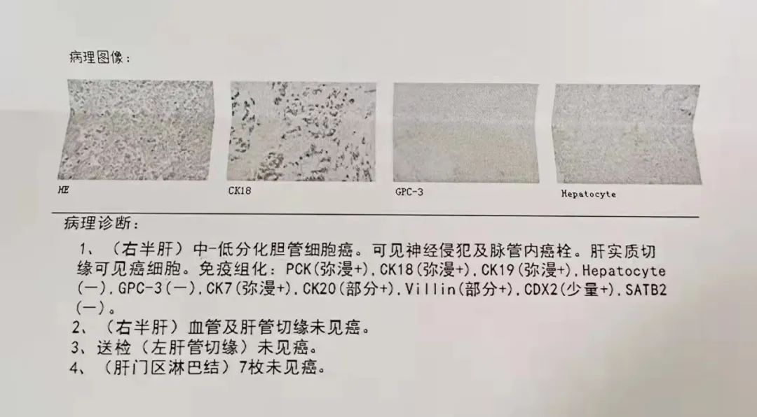 28岁生日那天,我开始了陪父亲抗癌的战役