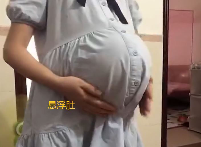 90后宝妈晒"悬浮肚",像塞了个大西瓜,被疑是"假肚子"__财经头条