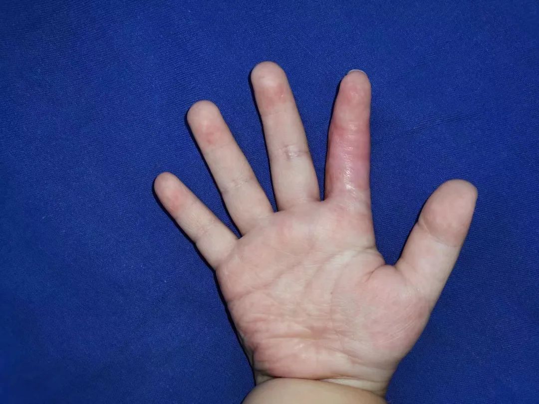 浙江3岁男孩摸了一下它，结果进了手术室！很多人家里都有休闲区蓝鸢梦想 - Www.slyday.coM