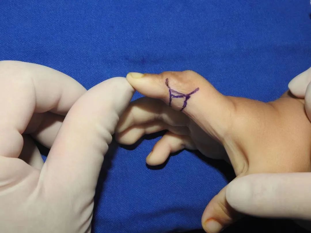 浙江3岁男孩摸了一下它，结果进了手术室！很多人家里都有休闲区蓝鸢梦想 - Www.slyday.coM