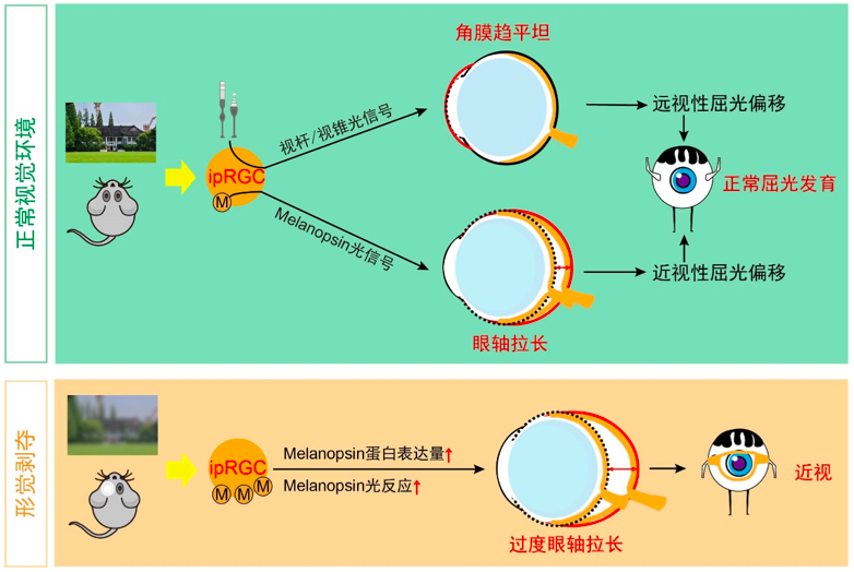 我国科学家在近视机制研究上取得新突破休闲区蓝鸢梦想 - Www.slyday.coM