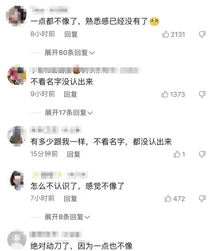 陈乔恩分享近照，大小脸明显烤瓷牙好抢镜，网友直呼认不出休闲区蓝鸢梦想 - Www.slyday.coM
