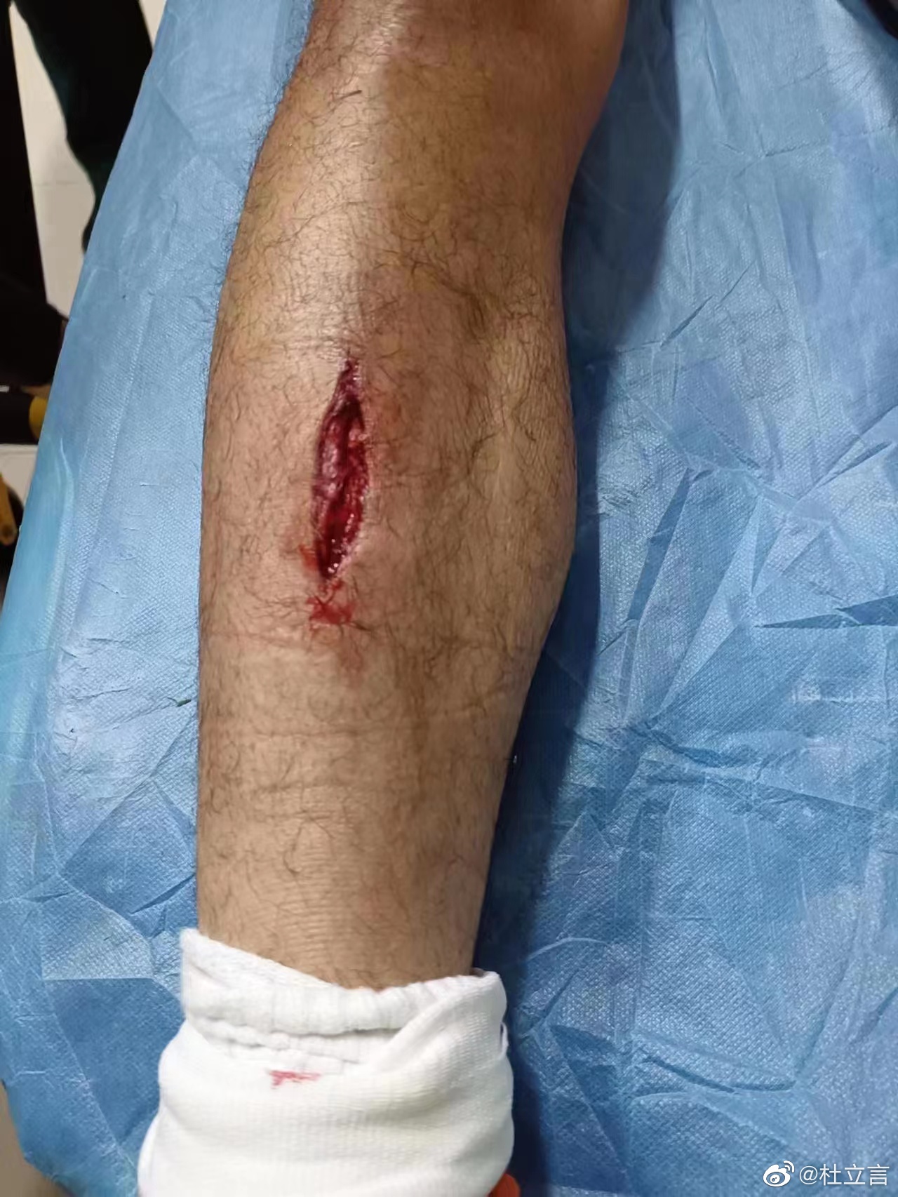 李金羽哽咽表扬武汉球员,非常感动球员受伤还在拼抢