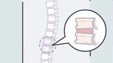 中国人的腰，是如何被毁掉的？休闲区蓝鸢梦想 - Www.slyday.coM