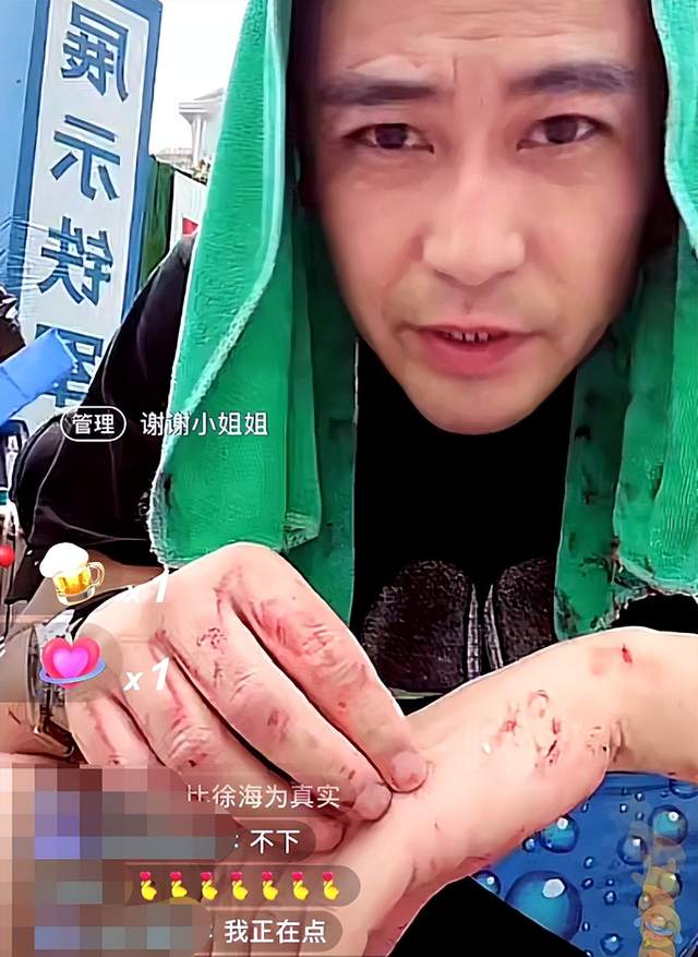 演员李飞直播摆摊卖鱼腿上沾满泥点子双手全是污垢被泡起皮