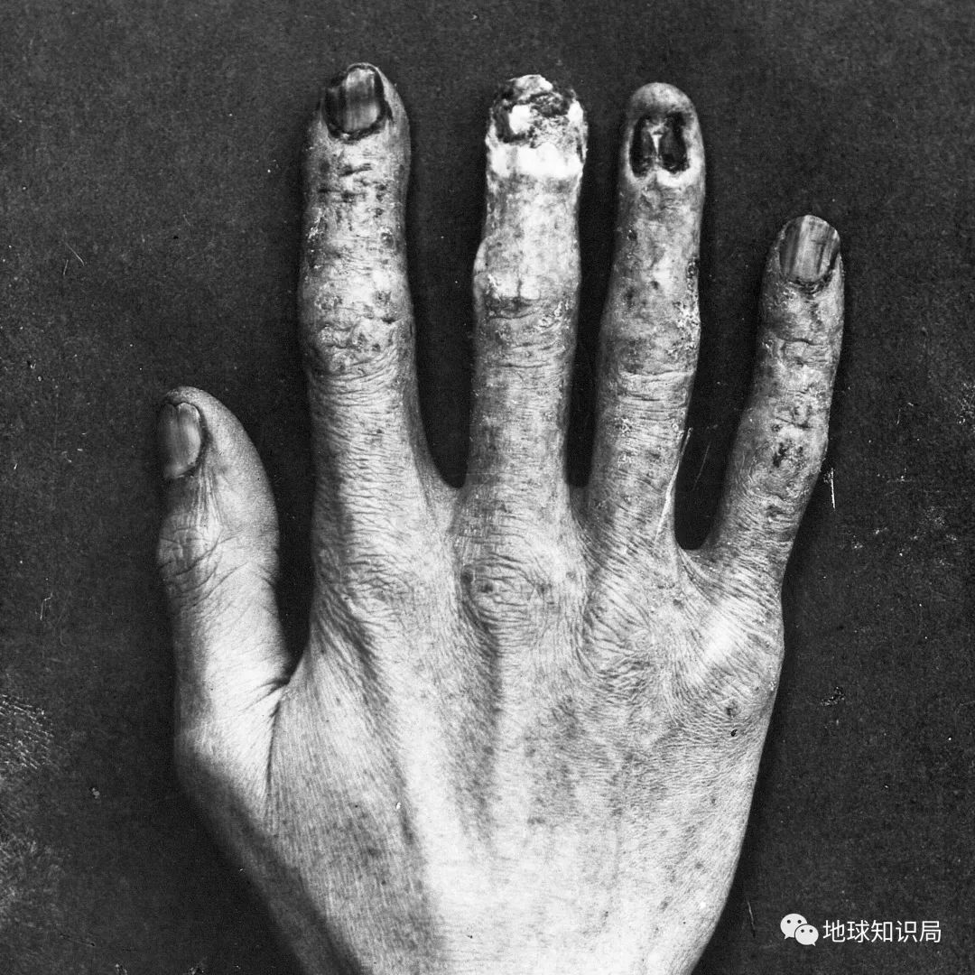 镭女郎浑身发绿光