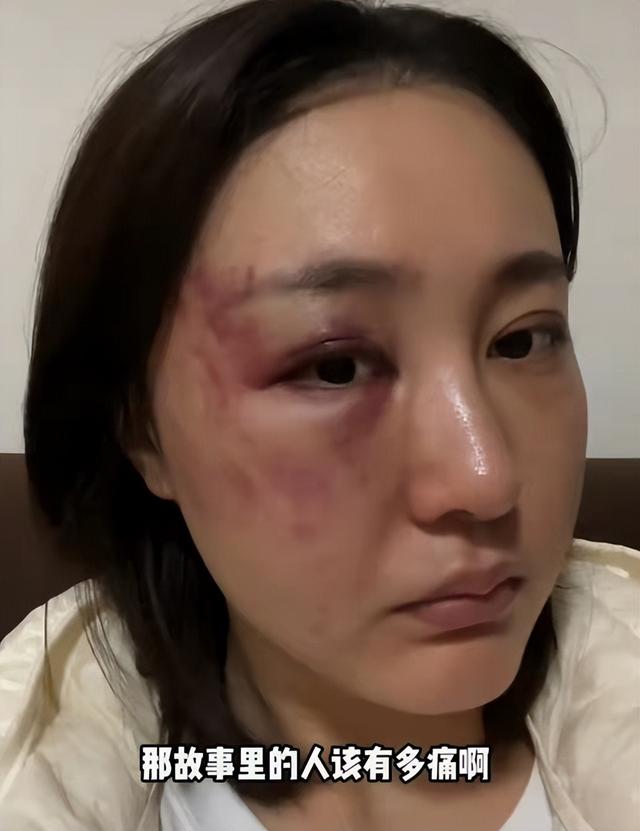 据悉,徐大宝外形靓丽,毕业于北电,曾出演影视剧《中二少侠求爱记》