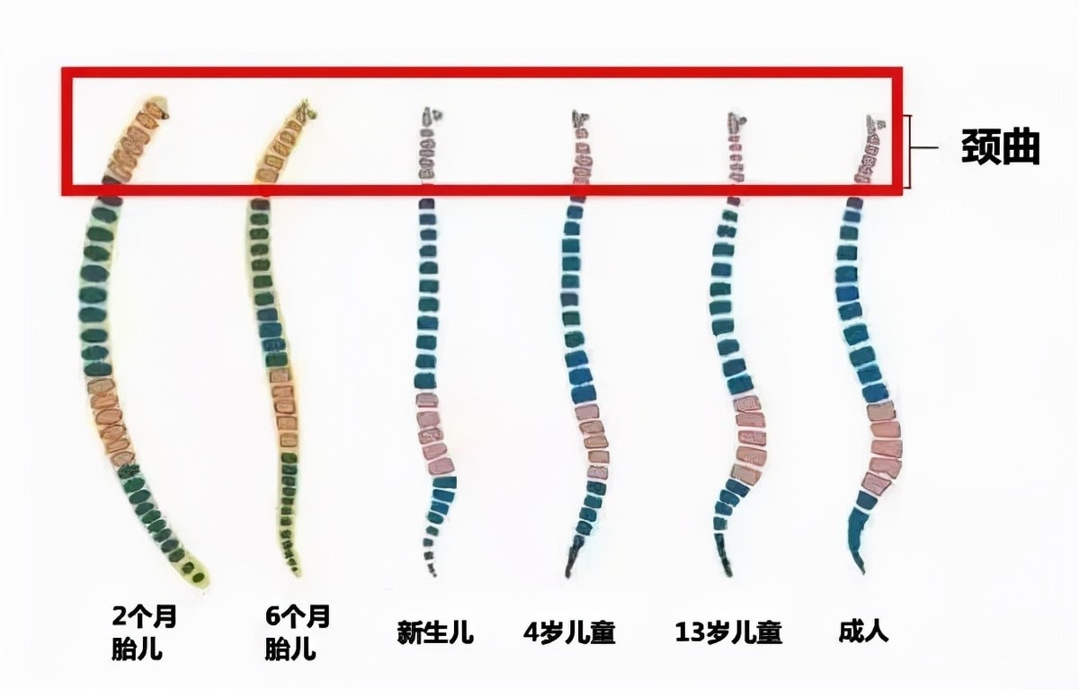 刚出生的宝宝颈部很短,并且脊柱没有弯曲是直的,3个月之内的婴儿脊椎