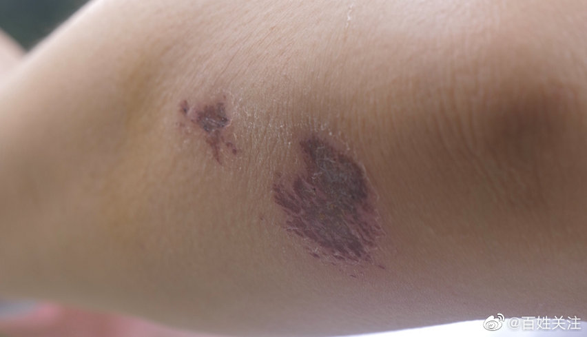 司机上厕所忘拉手刹溜车几十米 贵阳高速交警飞奔冲上失控公交车休闲区蓝鸢梦想 - Www.slyday.coM