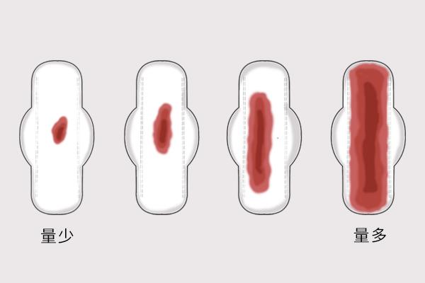 来 大姨妈 时 身体上有 肉 样的血块流出 是否正常 月经 新浪新闻