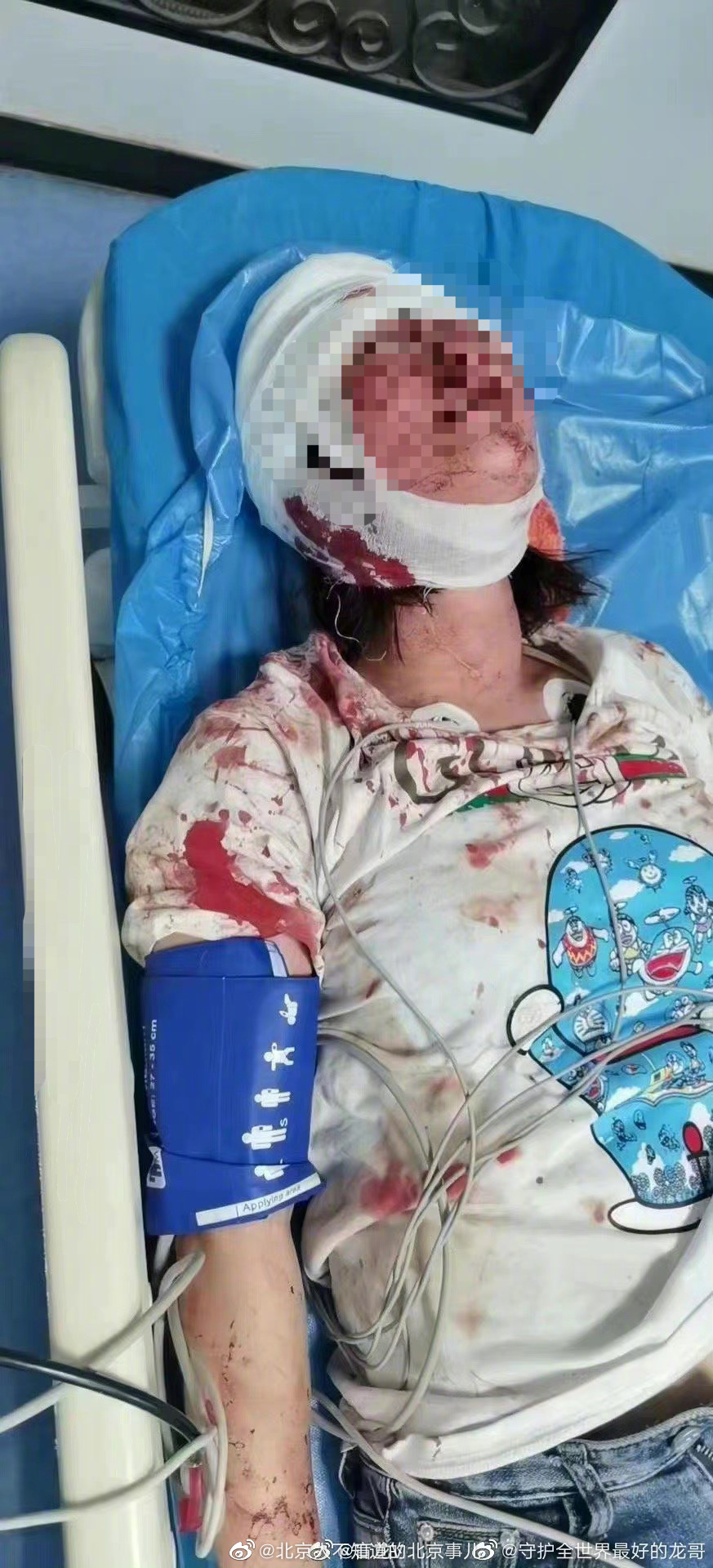 媒体:公布唐山暴力事件受害者近况宜早不宜迟休闲区蓝鸢梦想 - Www.slyday.coM 媒体:公布唐山暴力事件受害者近况宜早不宜迟休闲区蓝鸢梦想 - Www.slyday.coM