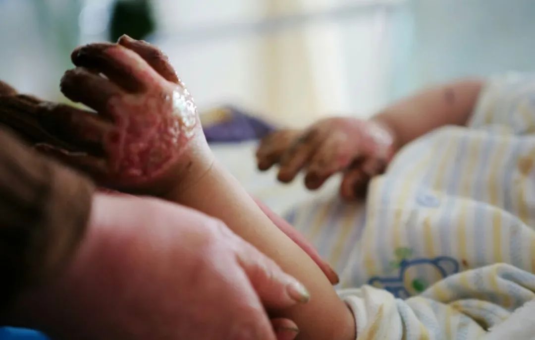 3岁孩子幼儿园午睡时意外死亡，过往身体健康无疾病，了解原因后家长濒临崩溃…休闲区蓝鸢梦想 - Www.slyday.coM