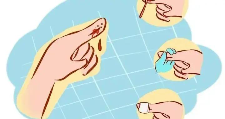 常见外伤的应急处理方法,医生帮你总结,现在学会关键时候用得上|烫伤|伤口|纱布|常德市|鼻骨_新浪新闻
