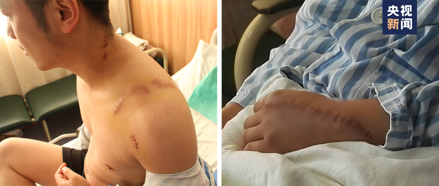 一件被鲜血染红的警服！女儿一句“爸爸是不是要死了”让妻子再也绷不住……休闲区蓝鸢梦想 - Www.slyday.coM