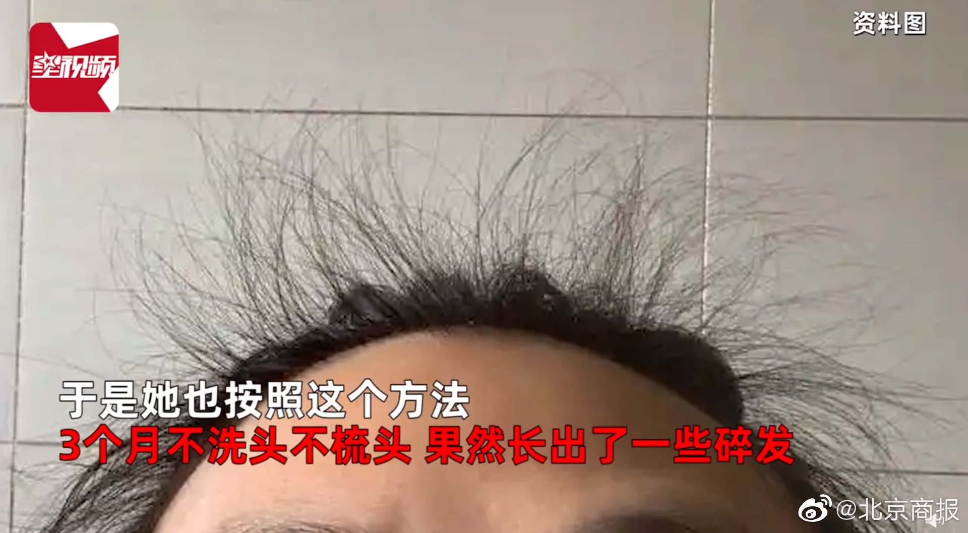 女子怕头秃3个月不洗头，惊喜长出碎发结果悲剧了！你为了防秃都干过啥休闲区蓝鸢梦想 - Www.slyday.coM