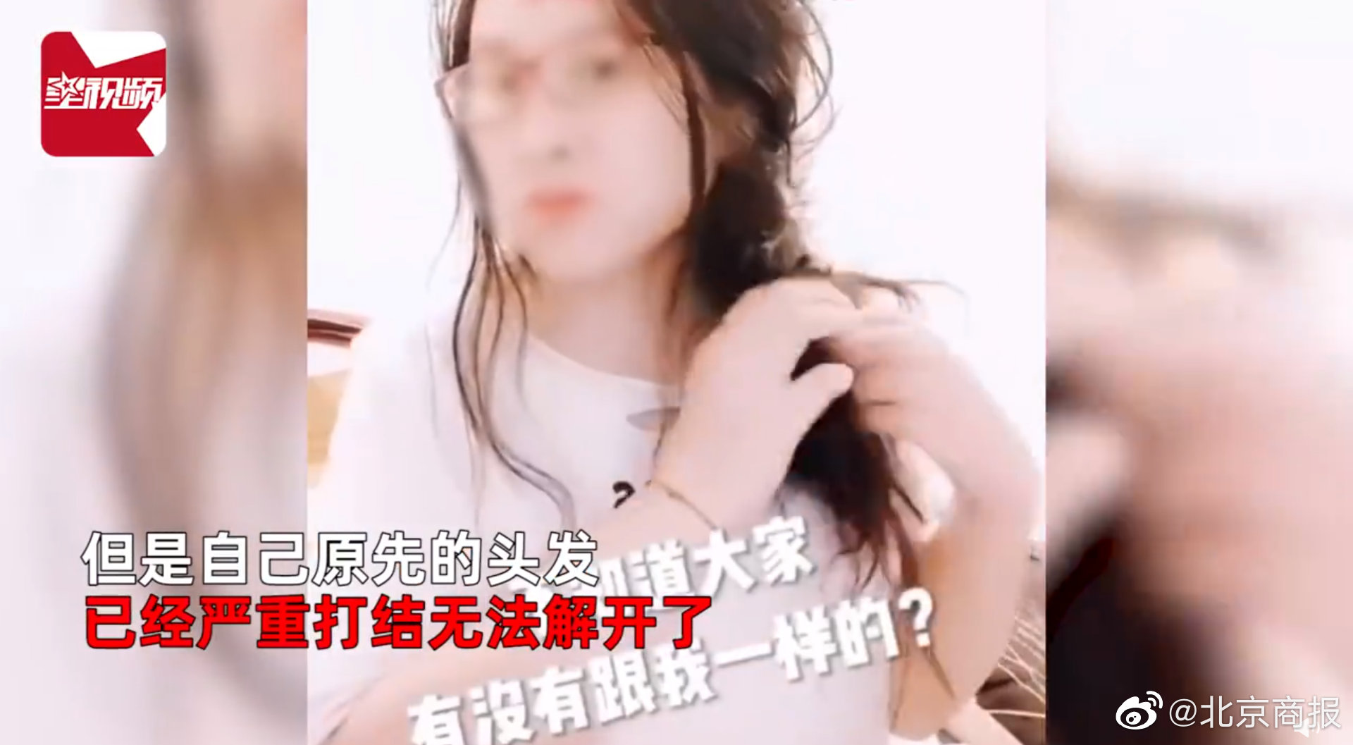 女子怕头秃3个月不洗头，惊喜长出碎发结果悲剧了！你为了防秃都干过啥休闲区蓝鸢梦想 - Www.slyday.coM