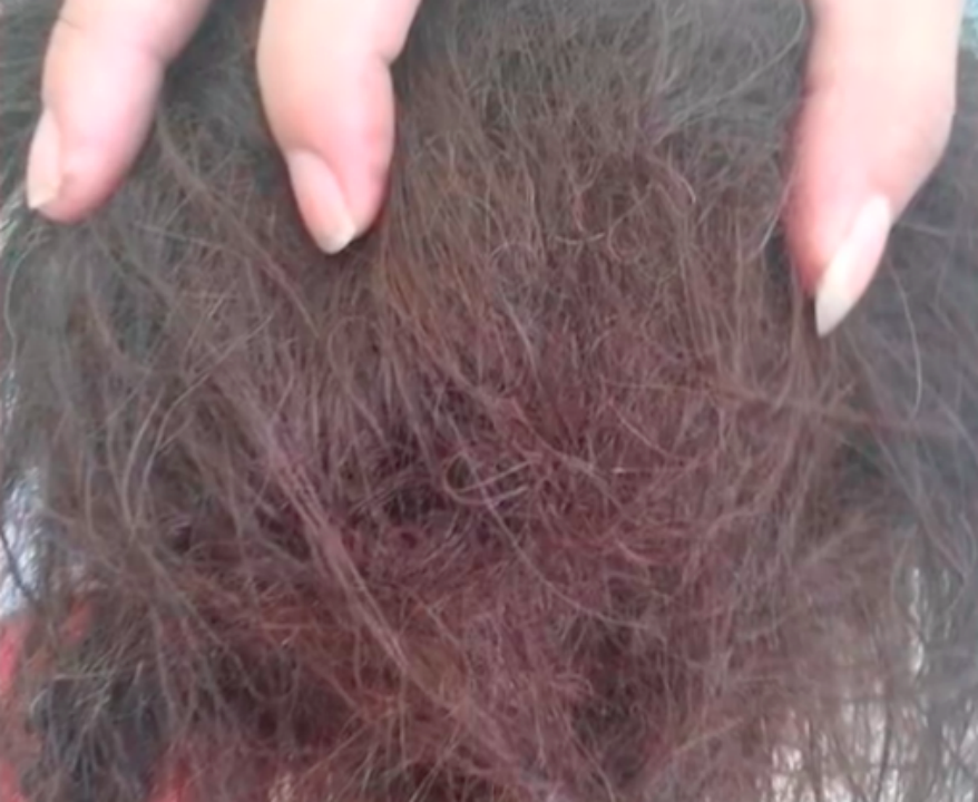 女子怕秃头3个月不洗头,头发严重打结,当事人:解开需要3000元休闲区蓝鸢梦想 - Www.slyday.coM 女子怕秃头3个月不洗头,头发严重打结,当事人:解开需要3000元休闲区蓝鸢梦想 - Www.slyday.coM