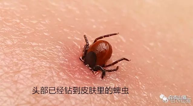 青岛20多人因蜱虫叮咬住院，4人不幸死亡。蜱虫为何会使人生病？被叮咬后该如何处理才安全？请及时用正确方法取出蜱虫！休闲区蓝鸢梦想 - Www.slyday.coM