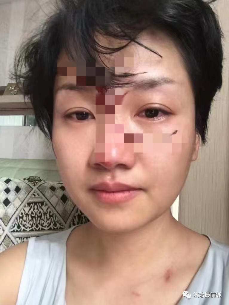 8年婚姻多次被家暴？ 广西一女子实名举报副教授丈夫！前妻也曾被……休闲区蓝鸢梦想 - Www.slyday.coM