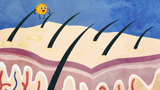 女子怕秃头3个月不洗，结果悲剧了休闲区蓝鸢梦想 - Www.slyday.coM