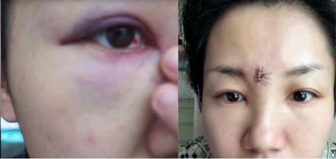 8年婚姻多次被家暴？ 广西一女子实名举报副教授丈夫！前妻也曾被……休闲区蓝鸢梦想 - Www.slyday.coM