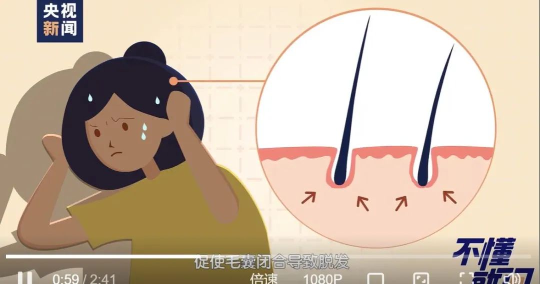 女子怕秃头3个月不洗，结果悲剧了休闲区蓝鸢梦想 - Www.slyday.coM