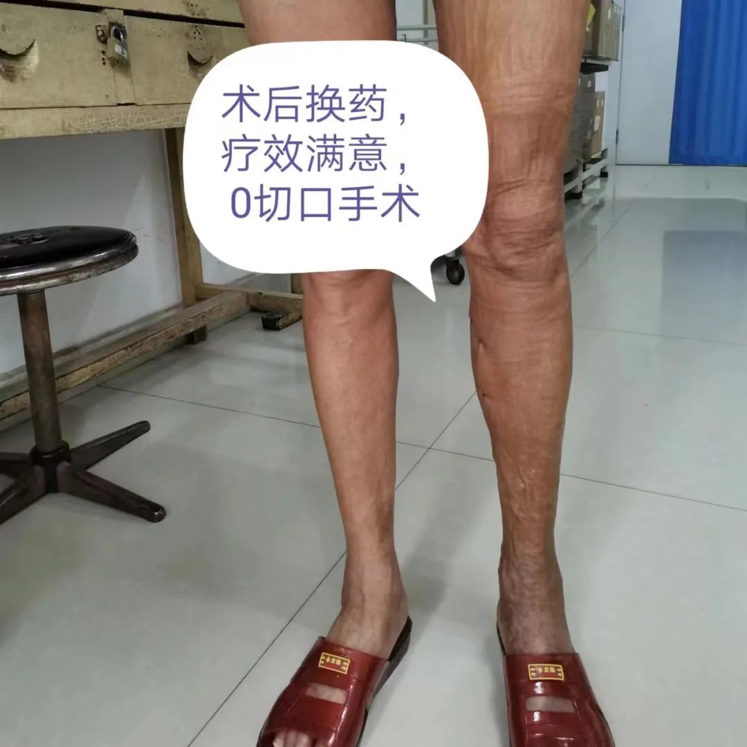 凌云县人民医院：践行微创化理念 施行不开刀手术 - 广西县域经济网