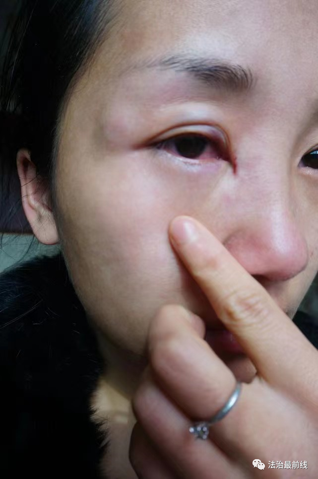 8年婚姻多次被家暴？ 广西一女子实名举报副教授丈夫！前妻也曾被……休闲区蓝鸢梦想 - Www.slyday.coM