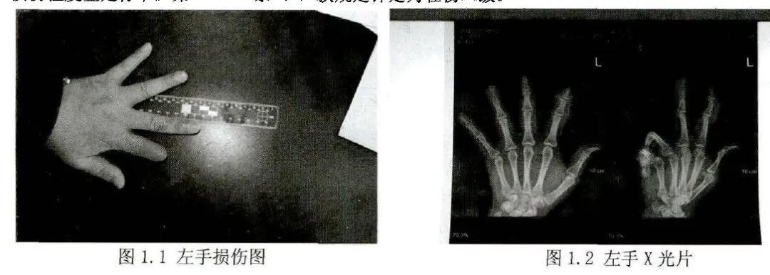 唐山被打女孩“轻伤不轻”，精神损害怎么算休闲区蓝鸢梦想 - Www.slyday.coM