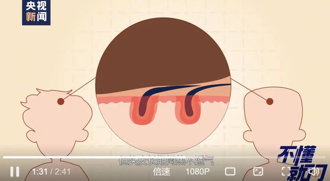 女子怕秃头3个月不洗，结果悲剧了休闲区蓝鸢梦想 - Www.slyday.coM