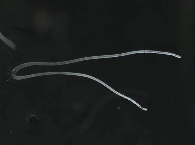 史上最大细菌!长达2厘米!科学家重大发现,这还算微生物吗休闲区蓝鸢梦想 - Www.slyday.coM 史上最大细菌!长达2厘米!科学家重大发现,这还算微生物吗休闲区蓝鸢梦想 - Www.slyday.coM