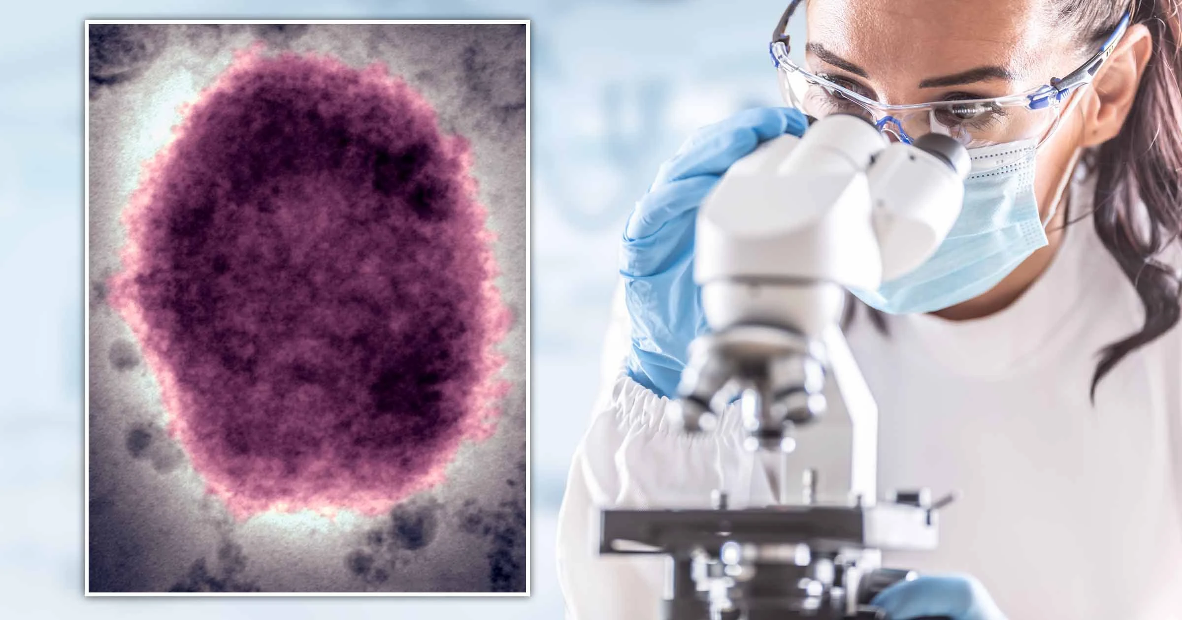 世卫禁止叫“非洲猴痘”,全球近5000病例,欧洲成疫情最严重地区休闲区蓝鸢梦想 - Www.slyday.coM 世卫禁止叫“非洲猴痘”,全球近5000病例,欧洲成疫情最严重地区休闲区蓝鸢梦想 - Www.slyday.coM