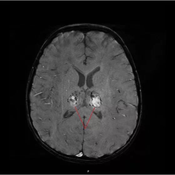 “感冒”第二天5岁娃进ICU！近期高发的这类疾病，5类人群需注意休闲区蓝鸢梦想 - Www.slyday.coM